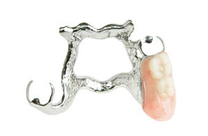 RPD Removable Denture Image