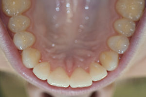 Berwyn-Dentist-After-1-300x201