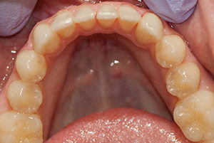 Berwyn-Dentist-After-2-300x201