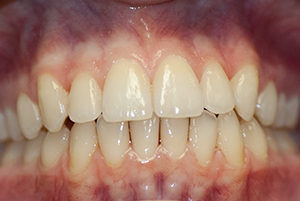 Berwyn-Dentist-After-3-300x201