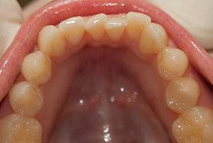 Berwyn-Dentist-Before-2-300x201
