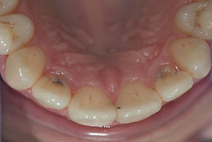Dentist-Berwyn-After-2-300x201