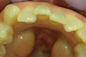 Dentist-Berwyn-Before-2-300x201