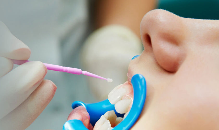 Why Should You Get Dental Sealants for Your Child?