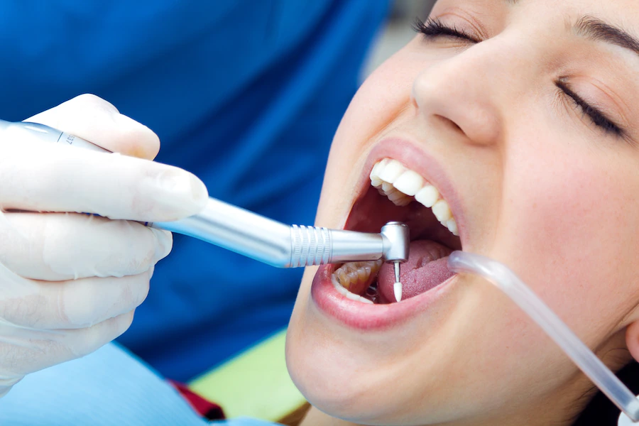 Composite Fillings Are A Great Option For Teeth Repair