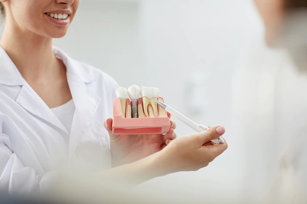Rejuvenate Your Look With Dental Implants: How They Can Make You Look Younger
