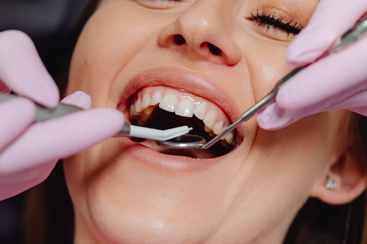 Dental-Crowns-and-Bridges-Berwyn