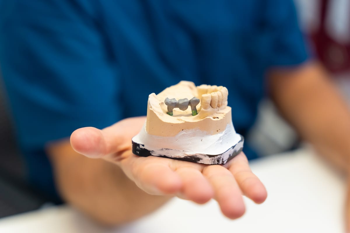 Dental Crowns in Berwyn